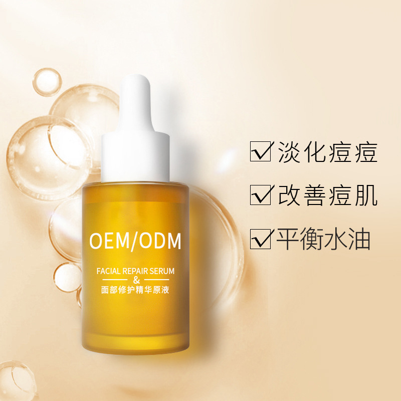 德宏傣族景颇族自治州_祛痘精华原液OEM